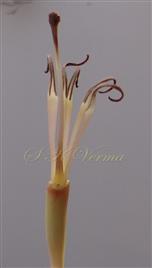  Bisexual flower (tepals removed)